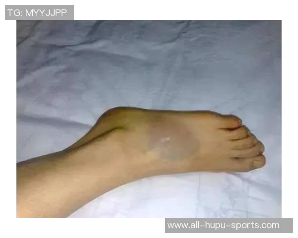 方硕脚踝90度扭伤！两年无休的他还是倒下了